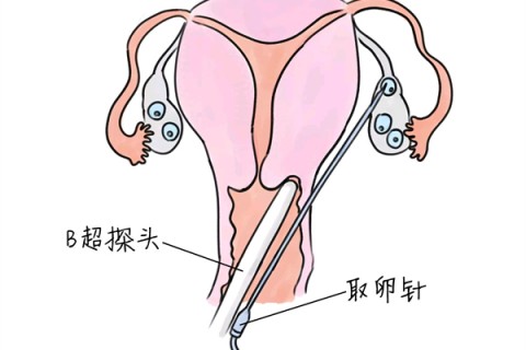 http://chengdu.vdtfzz.com/post/205.html|成都供卵助孕