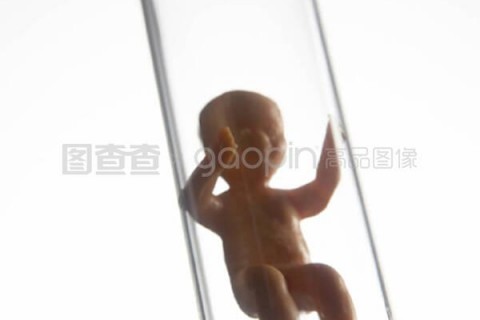 http://chengdu.vdtfzz.com/post/197.html|成都试管助孕